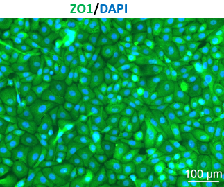 Human Cervical Epithelial Cells (HCerEpC) - Image 2