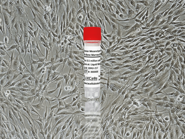 Human Mesenchymal Stem Cells-Bone Marrow (HMSC-bm)