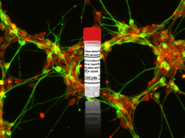 Human Motor Neurons (iPSC-derived, Normal)