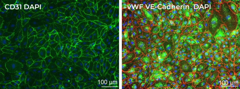 Human Brain Microvascular Endothelial Cells (HBMVEC) - iXCells