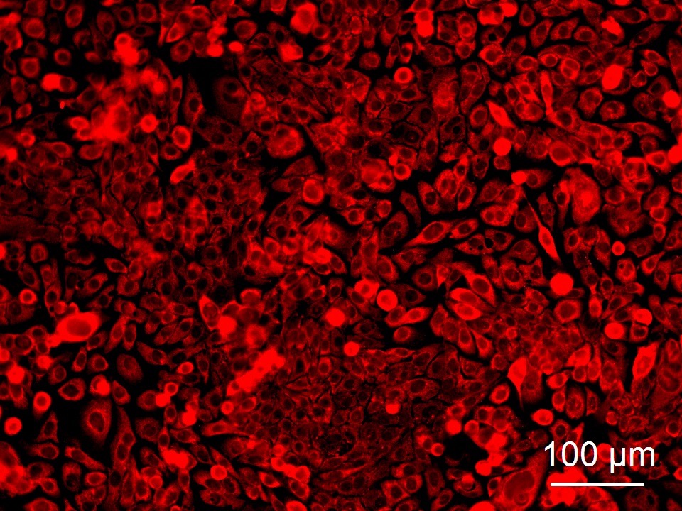 Human Colonic Epithelial Cells (HCoEpC) - Image 5