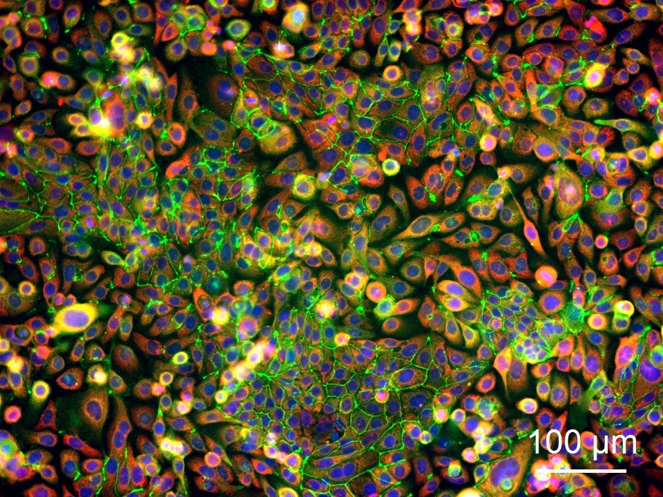 Human Colonic Epithelial Cells (HCoEpC) - Image 6