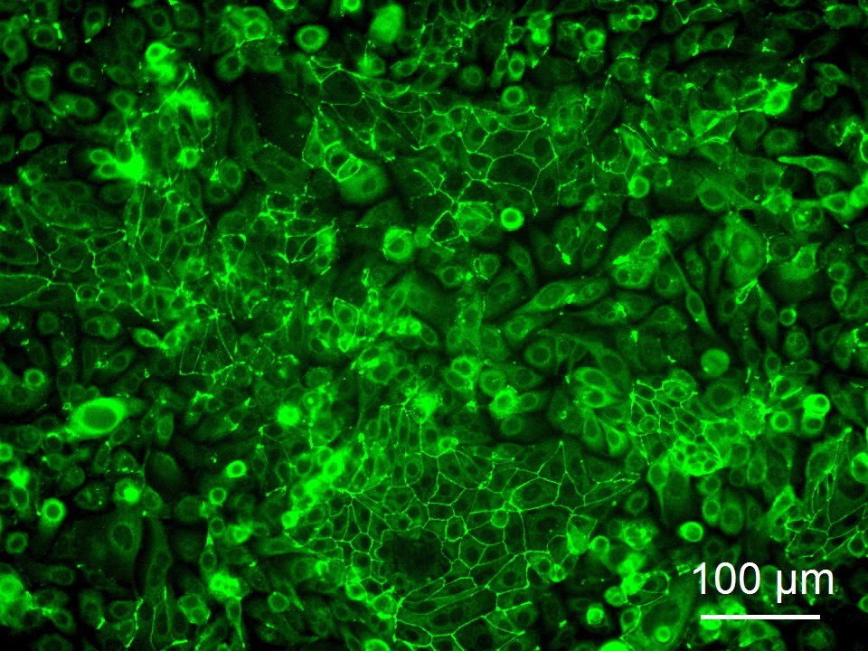 Human Colonic Epithelial Cells (HCoEpC) - Image 7