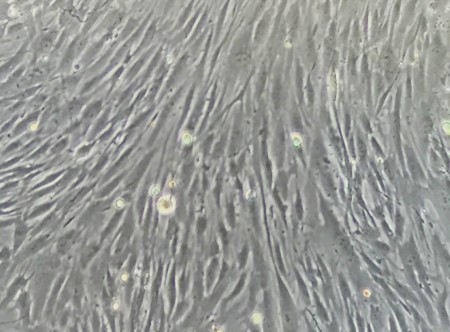 Human Dermal Fibroblasts-adult (HDF-a) - Image 2