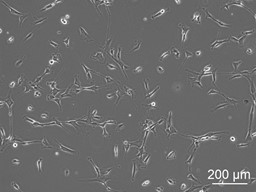 Human Pancreatic Stellate Cells (HPSC) - Image 2