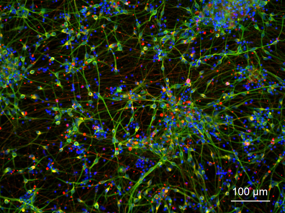 Human Cortical GABAergic Neurons 2.0 (iPSC-derived, Normal) - Image 2