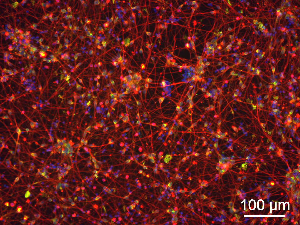 Human Cortical GABAergic Neurons 2.0 (iPSC-derived, Normal) - Image 3