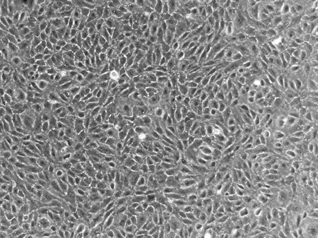 Human Aortic Endothelial Cells (HAOEC) - Image 2