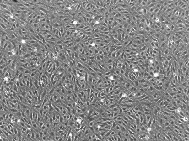Human Dermal Microvascular Endothelial Cells (HDMVEC) - Image 2