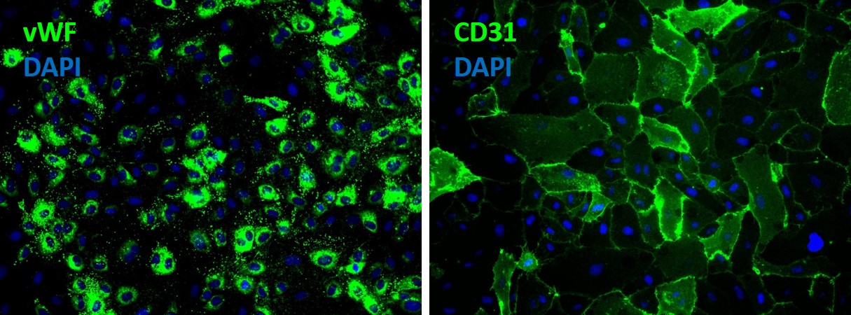 Human Aorta Endothelial Cells