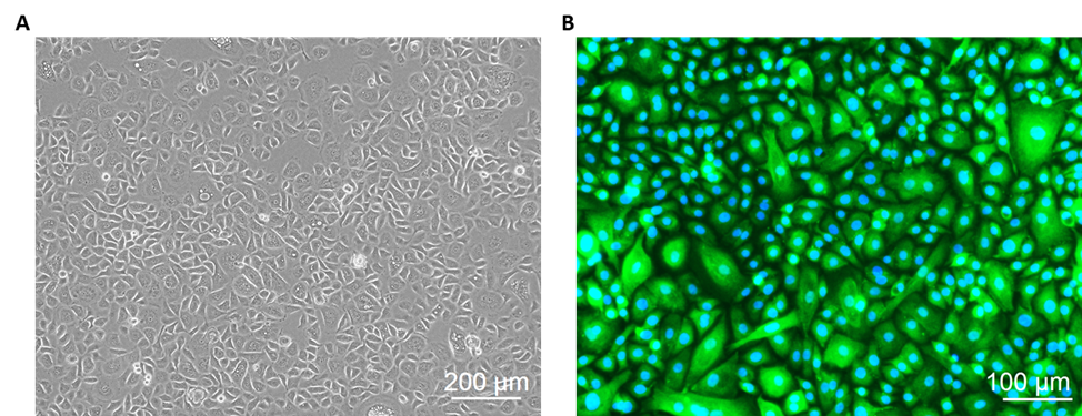 Human Bladder Epithelial Cells