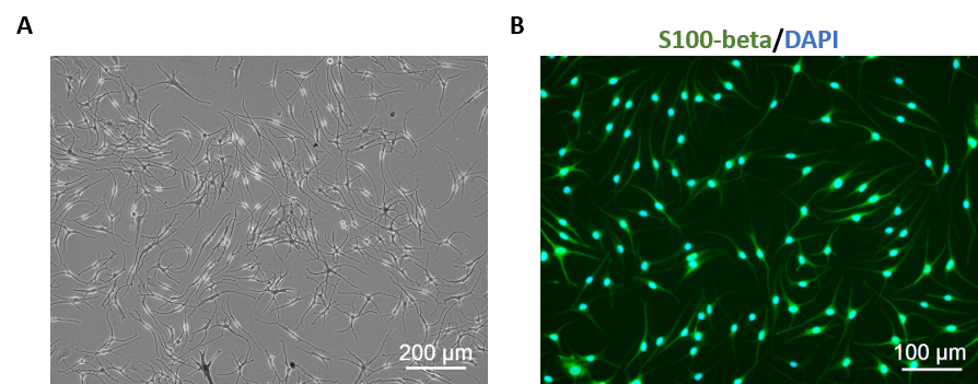 Human Epidermal Melanocytes dark