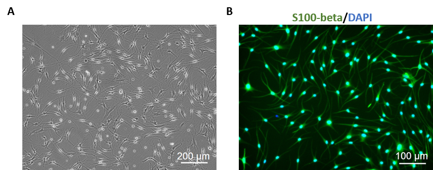Human Epidermal Melanocytes light