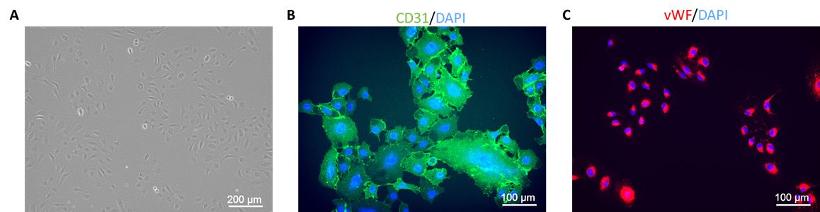 Human Intestinal Microvascular Endothelial Cells HIMEC