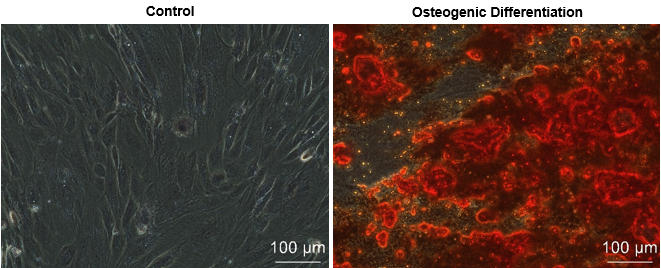 Human Placental Mesenchymal Stem Cells Figure 4