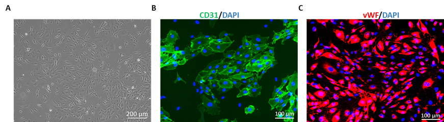 Human Pulmonary Microvascular Endothelial Cells 1