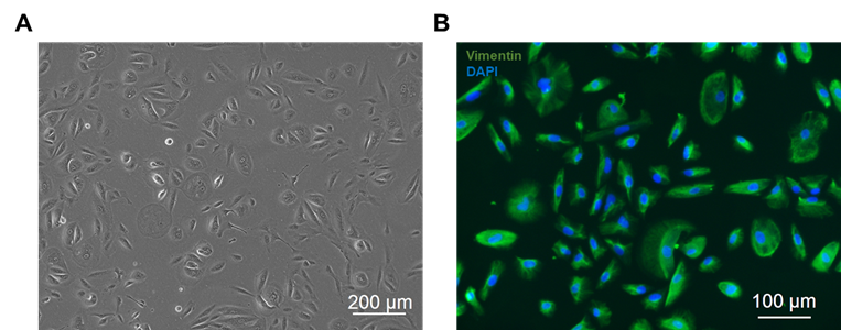 Human Renal Fibroblasts