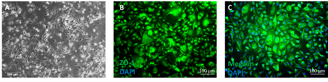 Human Renal Proximal Tubular Epithelial Cells HRPTEpC 2jpg