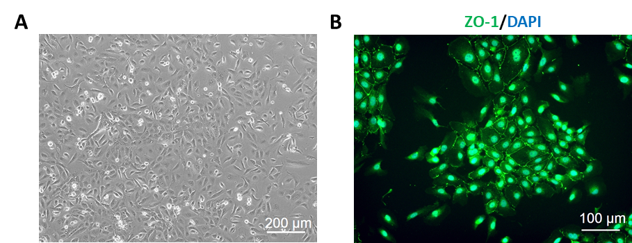 Human Small Intestine Epithelial Cells