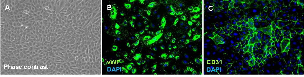 Human Umbilical Vein Endothelial Cells