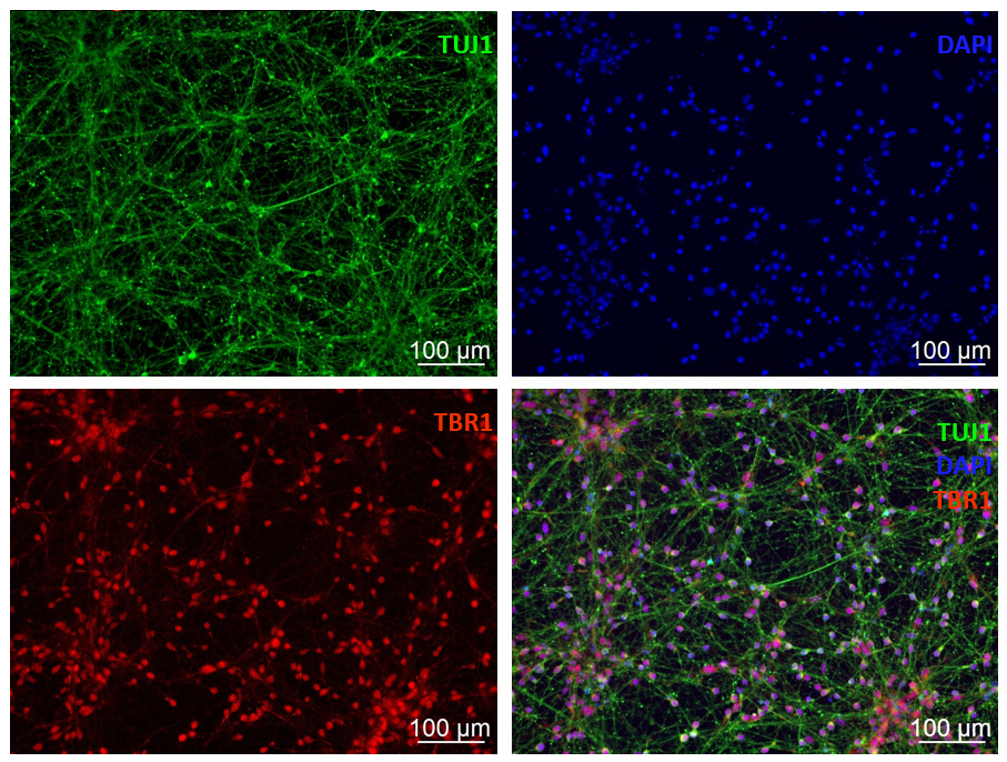 IPSC derived cortical neuron iXCells1