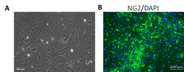 Mouse Brain Vascular Pericytes