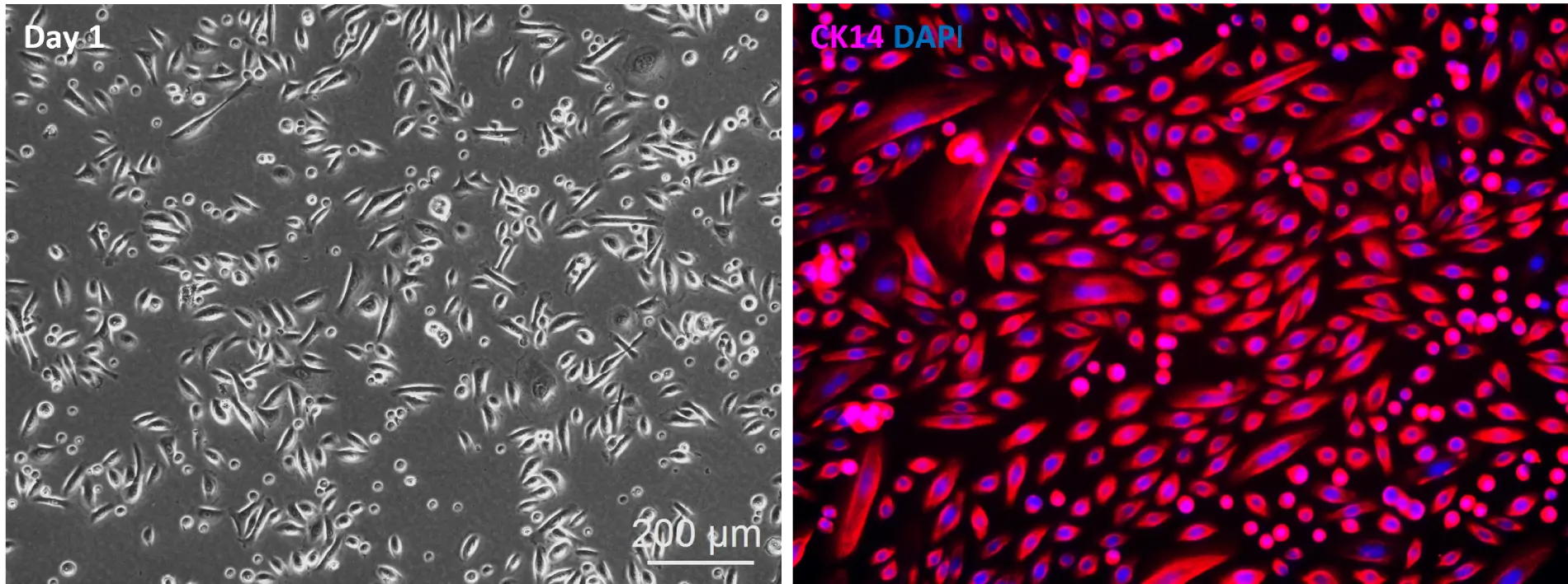 10HU 104 Human Mammary Epithelial Cells