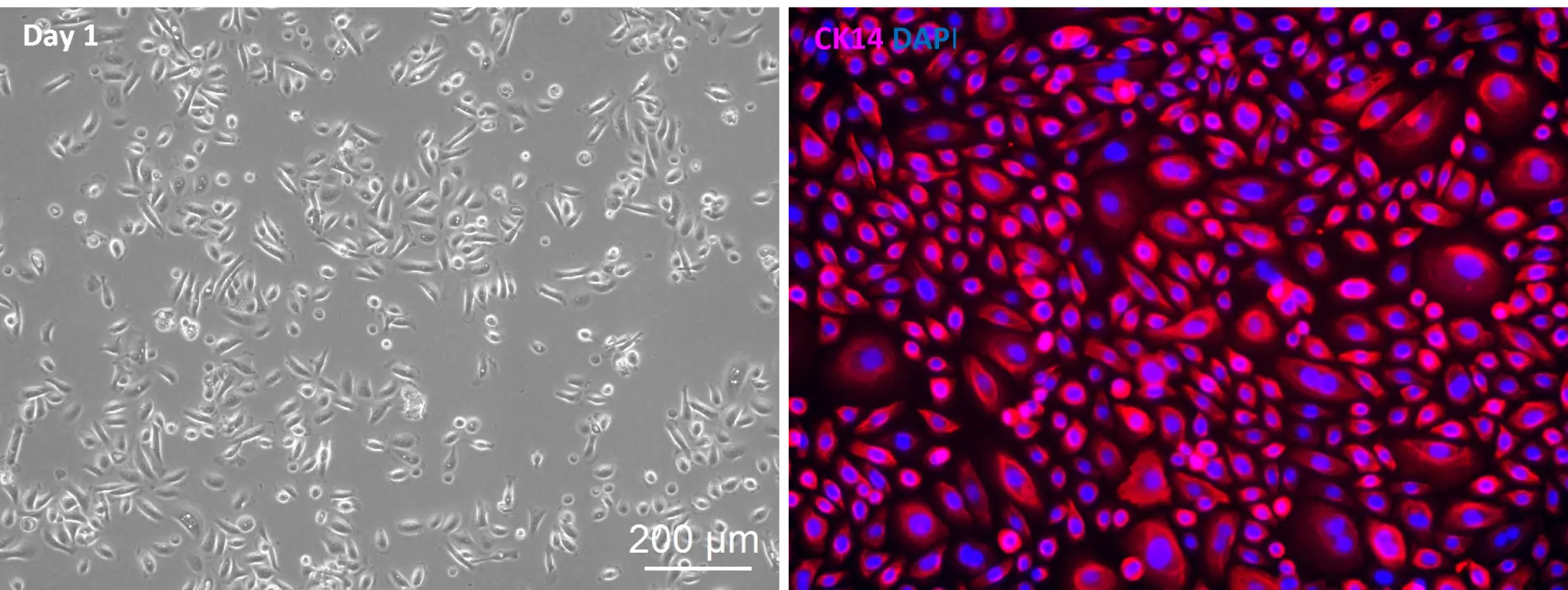 10HU 109 Human Prostate Epithelial Cells
