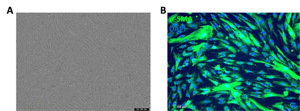Human Brain Vascular Pericytes