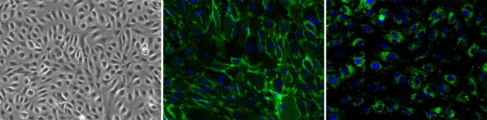 Human Coronary Artery Endothelial Cells