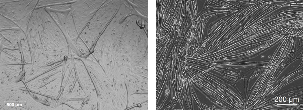 Mouse Skeletal Muscle Myoblast Cells MSkMM 1