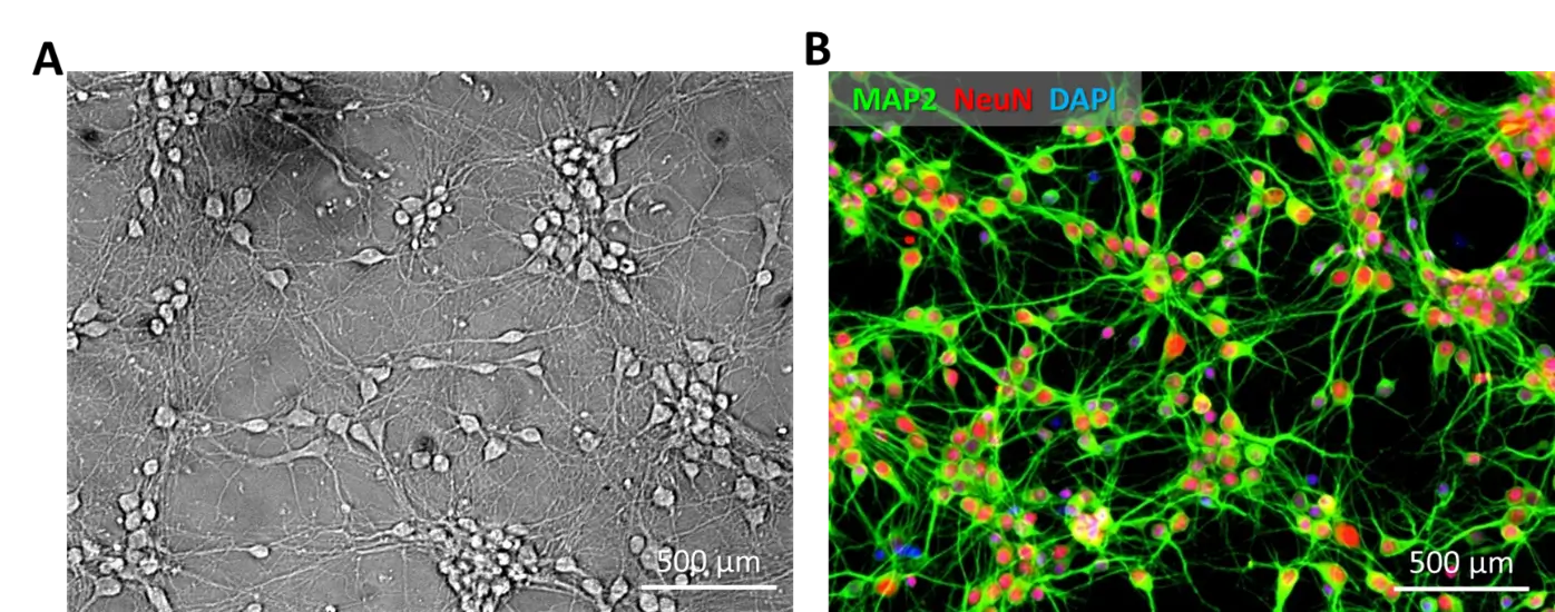 Rat Cortical Neurons