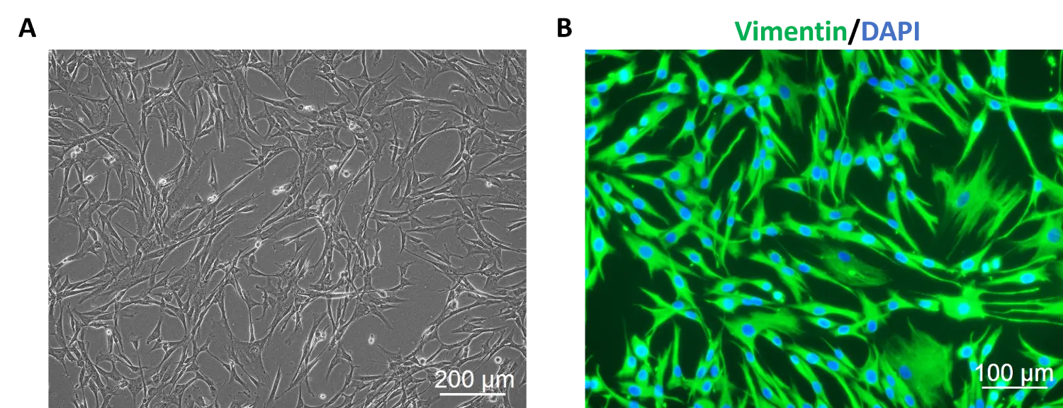 human pulmonary fibroblasts2