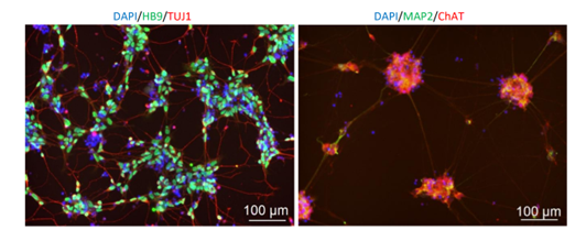 Immunofluorescence staining showing HB9 and ChAT positive cells on day 2 and 7 in culture respectively.